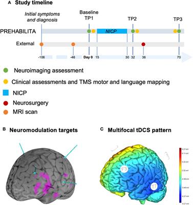 Exploring the neural basis of non-invasive prehabilitation in brain tumour patients: An fMRI-based case report of language network plasticity